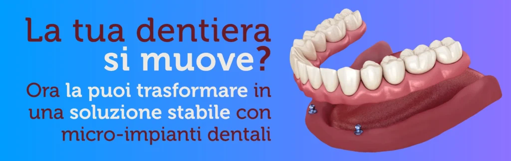 La tua dentiera si muove?