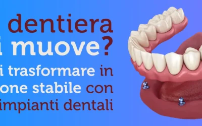 La tua dentiera si muove?